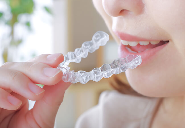 マウスピース矯正器具を入れようとしている女性
